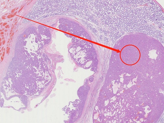 一例犬睾丸肿瘤的诊断与治疗