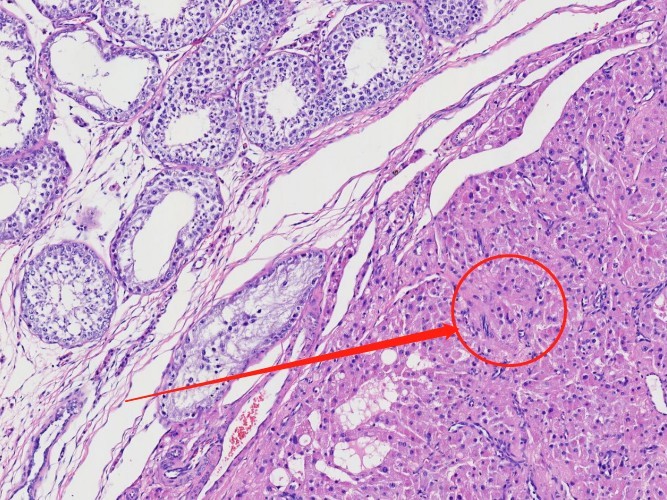 一例犬睾丸肿瘤的诊断与治疗