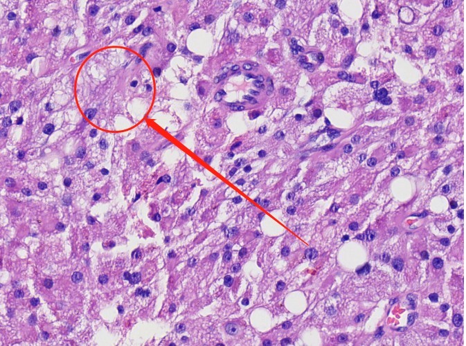 一例犬睾丸肿瘤的诊断与治疗