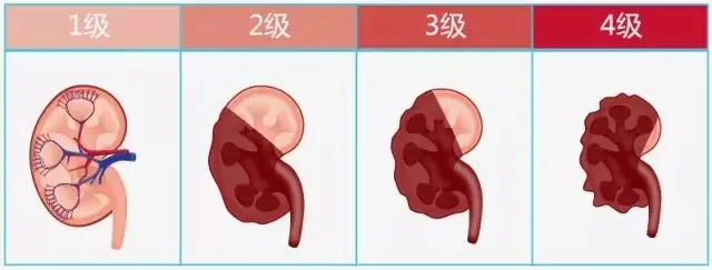 猫咪肾病，早期症状与预防