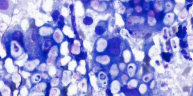 警惕！猫咪隐球菌感染，全面解读与防治建议