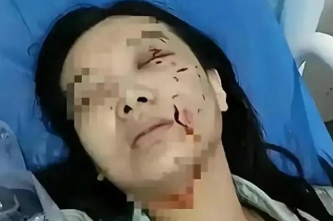 惹大了!松狮狗咬伤美少妇后续,狗主人可能面临800万天价赔偿