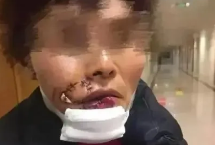 宠物狗咬人,主人凭啥不负责