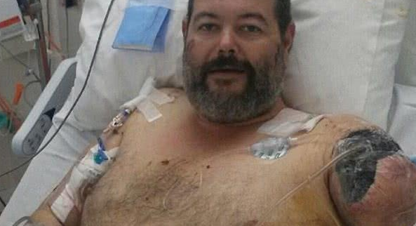 恶狗又伤人!澳洲男为客户修车惨遭2猎犬攻击,手臂被活生生撕掉