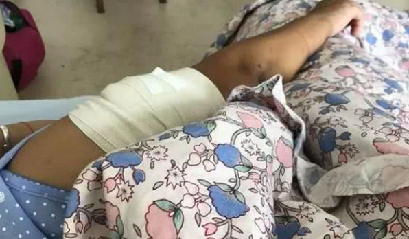 女子被养了5年的狗咬得血肉恍惚已经不是第一次
