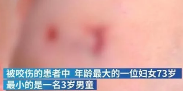 注意安全!江苏南通发现一条疯狗四处游荡,已咬伤21人