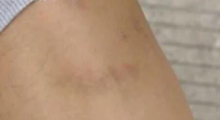 这条恶犬咬狗又咬人为什么主人就是不牵绳