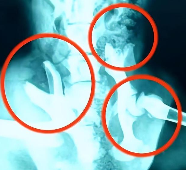 死去的狗狗从坟堆里爬了出来,靠坚强的意志爬行回家