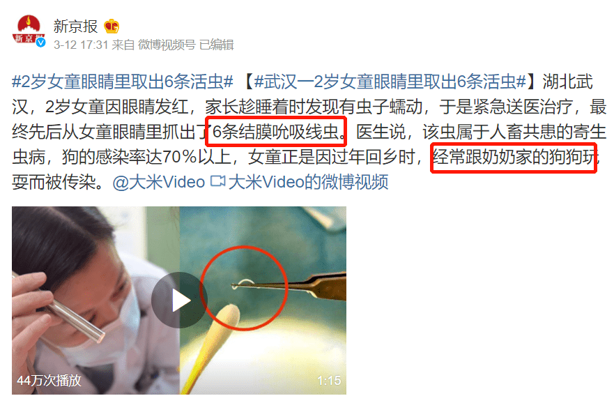 年轻妈妈被不牵狗绳的男主人殴打至骨折!