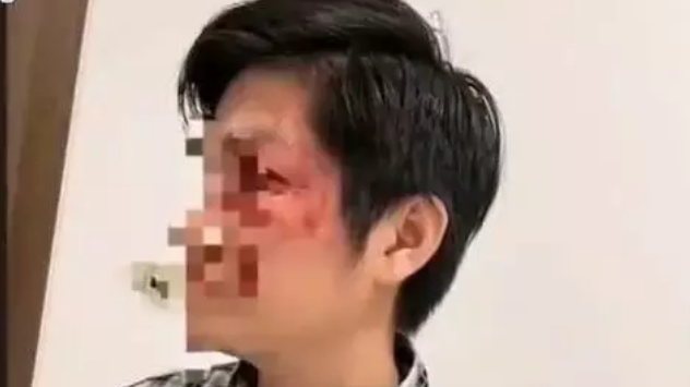 爸爸为了保护儿子，踢了没拴狗绳的狗，狗主人一拳KO爸爸