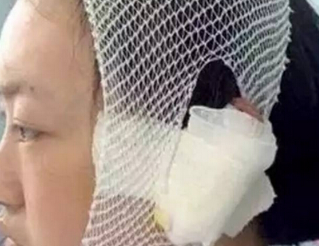 狗主因自家小狗被路人骂而狠心咬掉对方耳朵