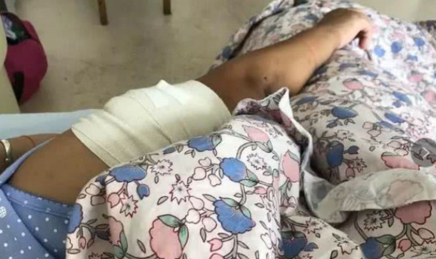 女子被养了5年的狗咬得血肉恍惚已经不是第一次