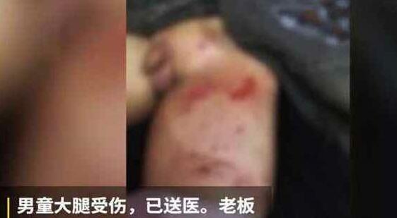 宠物店将恶犬栓门口,4岁男童被咬住不放,网友:老板真该死