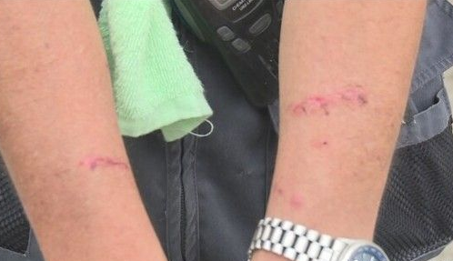 秋田犬没顾好冲河堤连咬3人 狗狗被抓