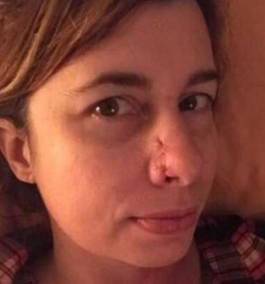 狗狗一直扑女子身上嗅她的鼻子,反常行为救下主人生命