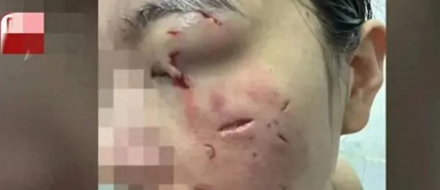 一向乖巧的宠物狗,被一女子逗发性情,后果不堪