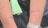 秋田犬没顾好冲河堤连咬3人 狗狗被抓