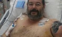 恶狗又伤人！澳洲男为客户修车惨遭2猎犬攻击，手臂被活生生撕掉