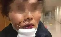 宠物狗咬人,主人凭啥不负责
