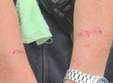 秋田犬没顾好冲河堤连咬3人 狗狗被抓