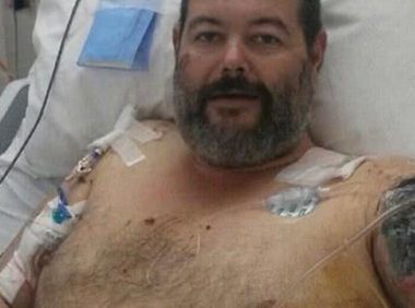 恶狗又伤人！澳洲男为客户修车惨遭2猎犬攻击，手臂被活生生撕掉