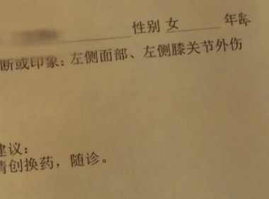 河北一女童被狗绊倒摔破脸，爱狗人士竟嫌医药费贵，你怎么看？