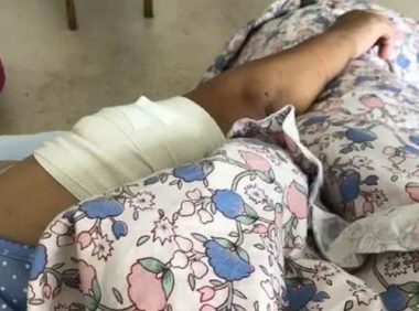 女子被养了5年的狗咬得血肉恍惚已经不是第一次