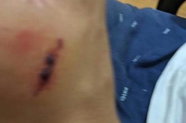 训犬师也被狗咬!柯基看似淡定自若,下秒把训犬师咬得鲜血淋漓