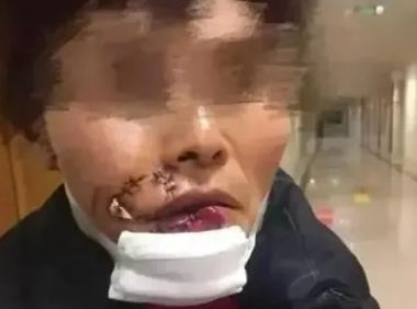 宠物狗咬人,主人凭啥不负责